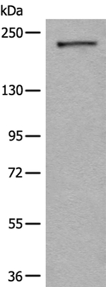 MRCK alpha Antibody in Western Blot (WB)
