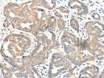 CDK2AP1 Polyclonal Antibody