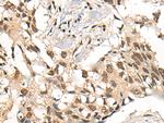 CECR6 Antibody in Immunohistochemistry (Paraffin) (IHC (P))