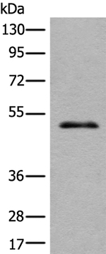 CECR6 Antibody in Western Blot (WB)
