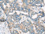 CEP72 Antibody in Immunohistochemistry (Paraffin) (IHC (P))