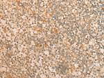 CFHR2 Antibody in Immunohistochemistry (Paraffin) (IHC (P))