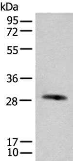 CFHR2 Antibody in Western Blot (WB)