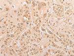 CISD1 Polyclonal Antibody
