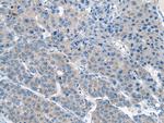 CITED4 Polyclonal Antibody