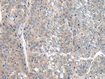 CLTCL1 Antibody in Immunohistochemistry (Paraffin) (IHC (P))