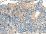 CNTNAP1 Polyclonal Antibody
