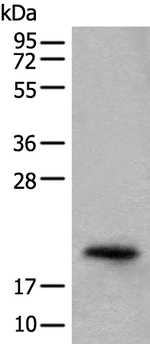 CRYGS Polyclonal Antibody