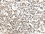 KMT2C Antibody in Immunohistochemistry (Paraffin) (IHC (P))