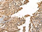 MEIOB Polyclonal Antibody