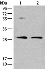 NAT8L Polyclonal Antibody