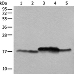 NDUFB11 Antibody in Western Blot (WB)