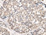 NREP Antibody in Immunohistochemistry (Paraffin) (IHC (P))