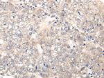 NREP Antibody in Immunohistochemistry (Paraffin) (IHC (P))