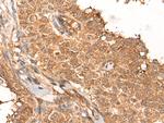 NRG2 Antibody in Immunohistochemistry (Paraffin) (IHC (P))