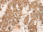 NRG2 Polyclonal Antibody