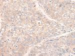 C1orf57 Polyclonal Antibody