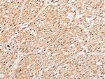 WBP5 Polyclonal Antibody