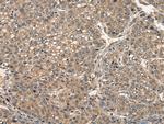 CD153 Antibody in Immunohistochemistry (Paraffin) (IHC (P))
