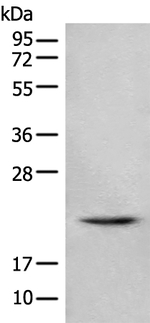 TSEN15 Antibody in Western Blot (WB)