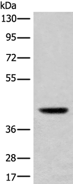 USP12 Antibody in Western Blot (WB)