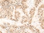 UTY Polyclonal Antibody