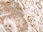 VGLL3 Antibody in Immunohistochemistry (Paraffin) (IHC (P))