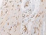 VGLL3 Antibody in Immunohistochemistry (Paraffin) (IHC (P))