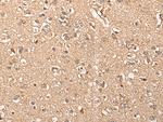 WDFY4 Polyclonal Antibody