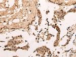 ZNF467 Polyclonal Antibody