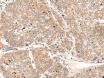 ZNF467 Antibody in Immunohistochemistry (Paraffin) (IHC (P))