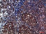 CYFIP2 Polyclonal Antibody