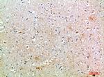 MIB1 Antibody in Immunohistochemistry (Paraffin) (IHC (P))