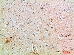 MIB1 Antibody in Immunohistochemistry (Paraffin) (IHC (P))