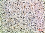 CD299 (DC-SIGN/L) Polyclonal Antibody