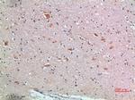 FZD9 Antibody in Immunohistochemistry (Paraffin) (IHC (P))