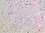 FZD9 Antibody in Immunohistochemistry (Paraffin) (IHC (P))