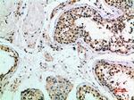 FZD9 Antibody in Immunohistochemistry (Paraffin) (IHC (P))
