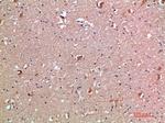 IL18RAP Antibody in Immunohistochemistry (Paraffin) (IHC (P))