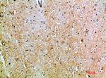 TSPAN7 Antibody in Immunohistochemistry (Paraffin) (IHC (P))