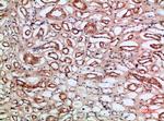 Tetranectin Antibody in Immunohistochemistry (Paraffin) (IHC (P))