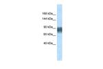 AVIL Polyclonal Antibody