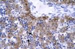ERCC8 Antibody in Immunohistochemistry (IHC)