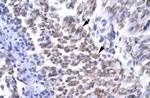 ERCC8 Polyclonal Antibody