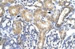 ACSL1 Antibody in Immunohistochemistry (IHC)