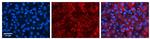 ACSL1 Polyclonal Antibody