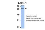 ACSL1 Antibody in Western Blot (WB)