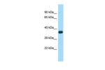 WNT8B Polyclonal Antibody