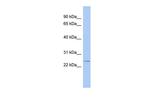 EVI2A Polyclonal Antibody