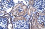 RGS13 Polyclonal Antibody